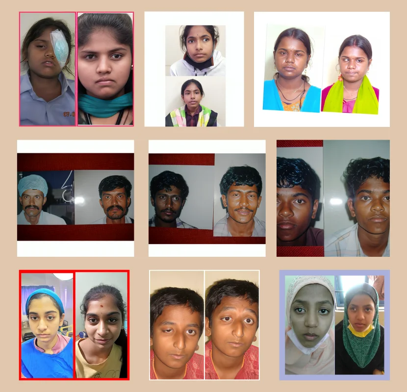 Usha Kiran Eye Hospital