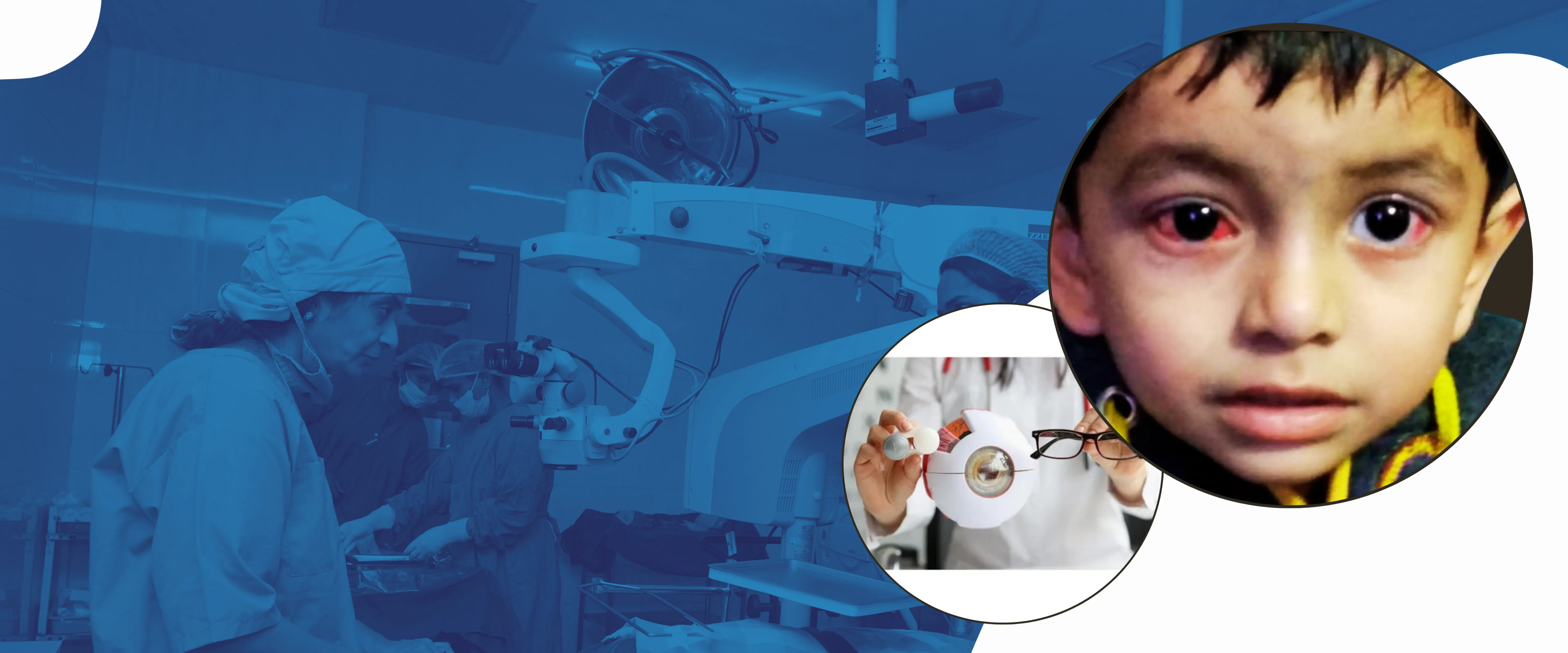 Paediatric Ophthalmology